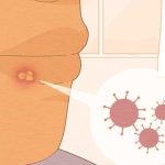6 Homemade Treatments With Green Tea