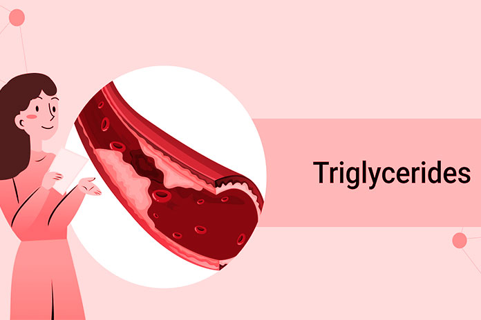 Triglycerides The Risk Of Junk Food